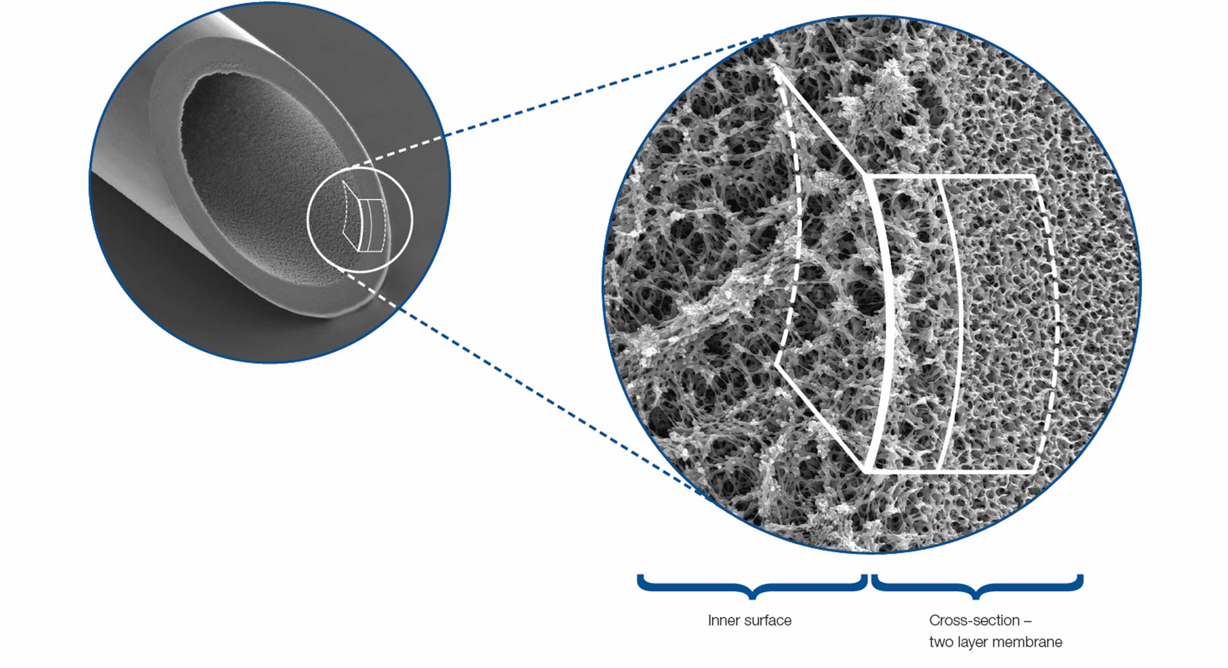 BAS020_diagram-structure-plasmafilters